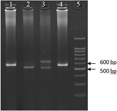 Significant Association of DNASE1 Variable Number Tandem Repeats and Single Nucleotide Polymorphisms With Gastric Cancer